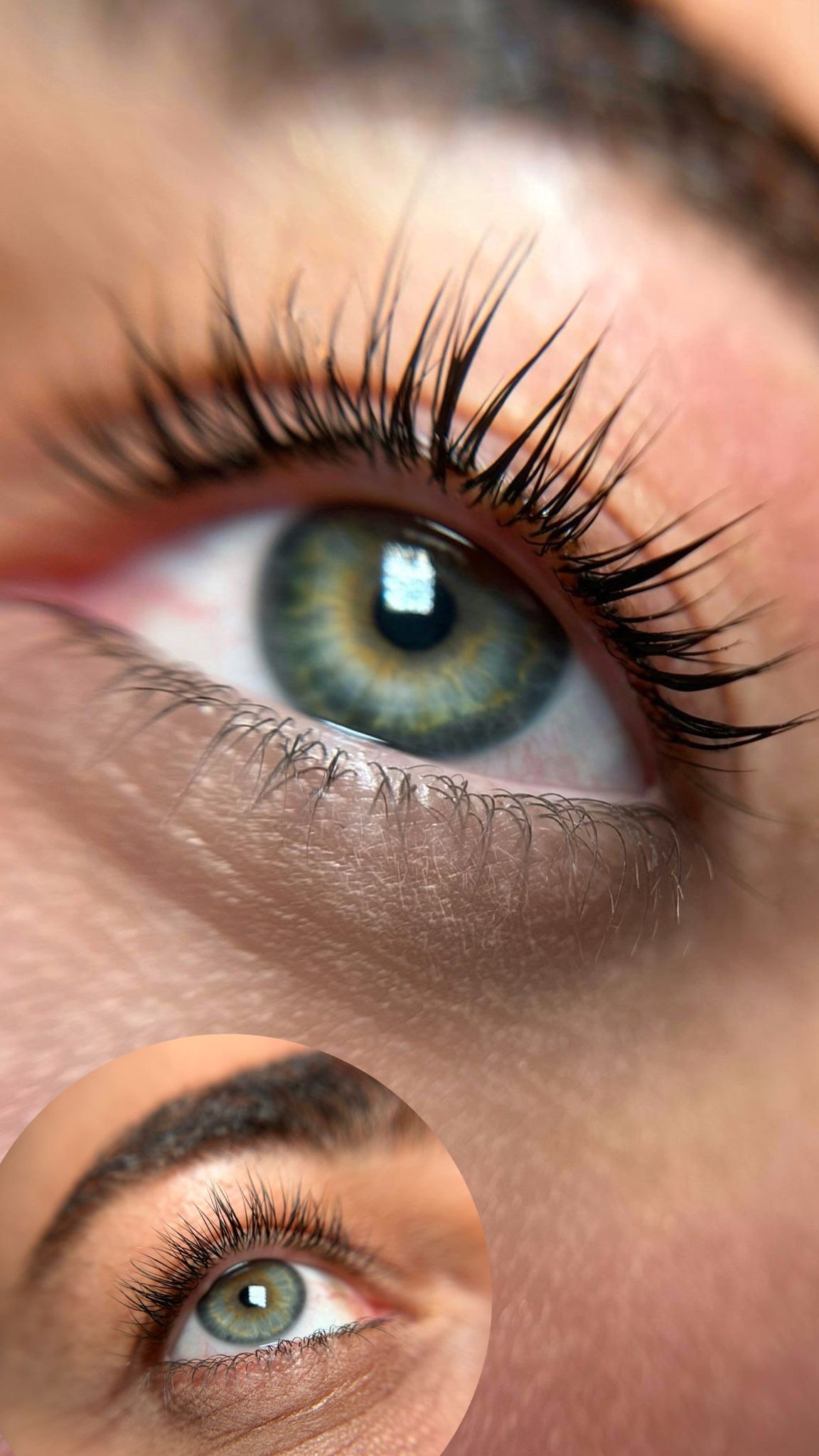 טיפול עיניים 2