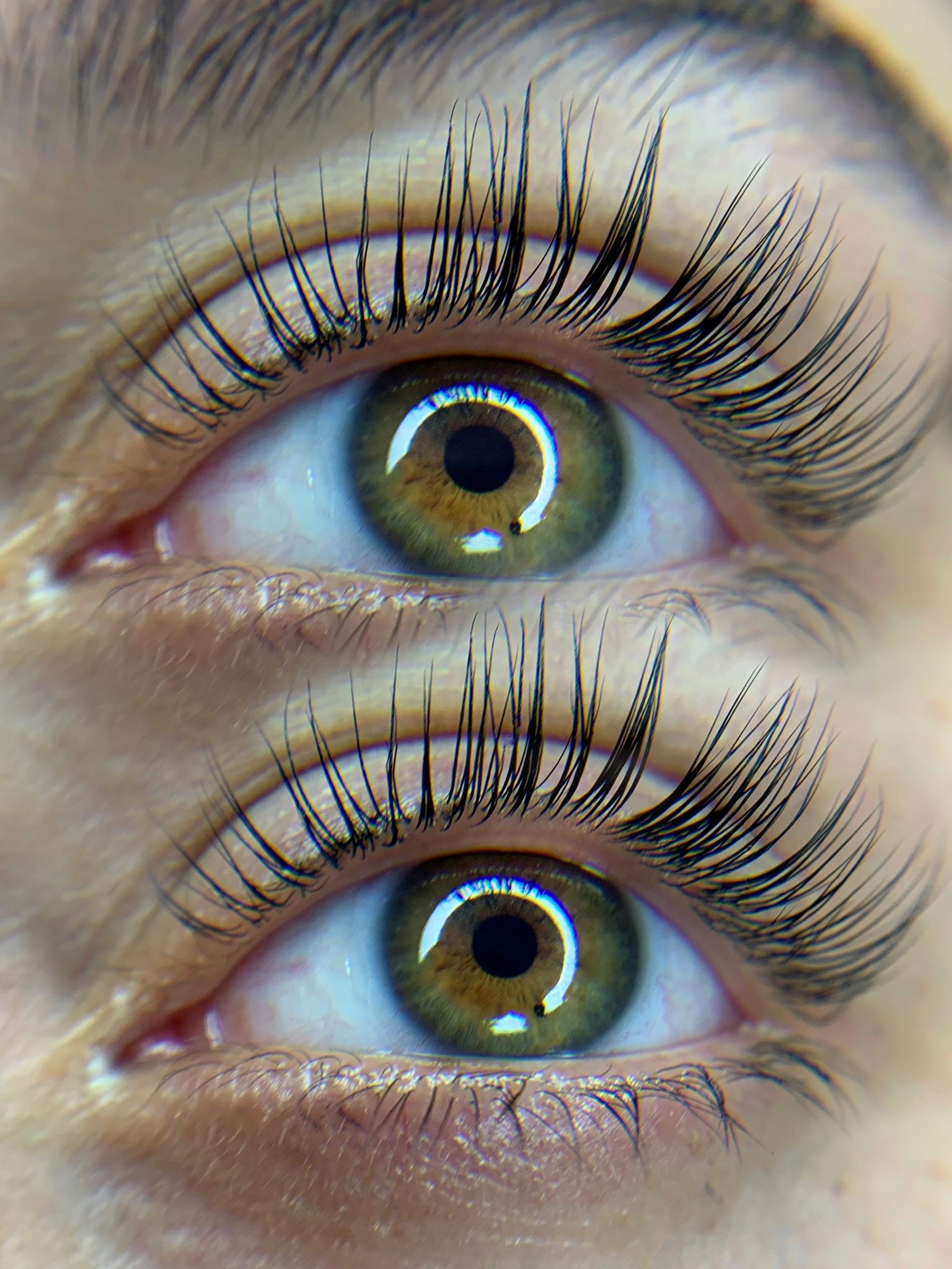 טיפול עיניים 3